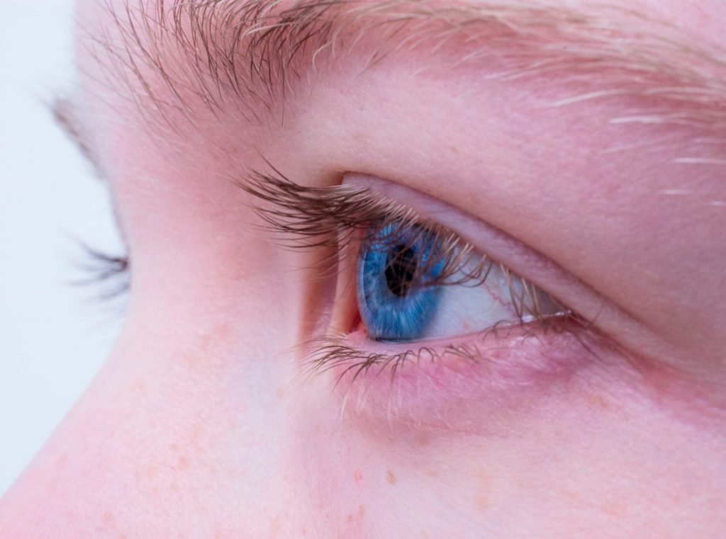 Способы устранения синяка под глазом в кратчайшие сроки